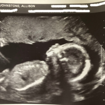 Babylist Registry Photo.