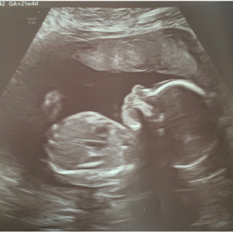 Babylist Registry Photo.