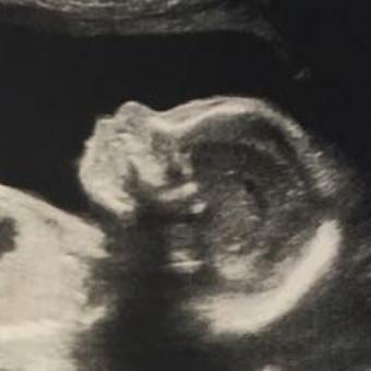 Babylist Registry Photo.