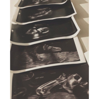 Babylist Registry Photo.