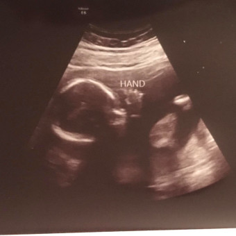 Babylist Registry Photo.