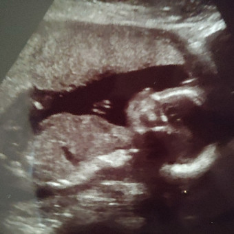 Babylist Registry Photo.