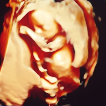 Babylist Registry Photo.