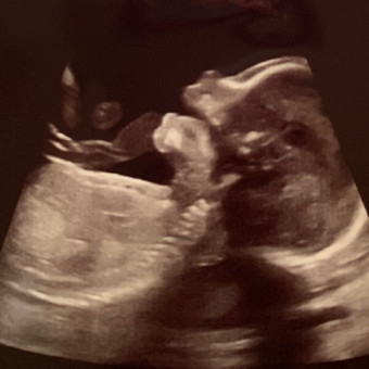 Babylist Registry Photo.