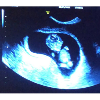 Babylist Registry Photo.