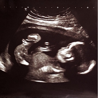 Babylist Registry Photo.