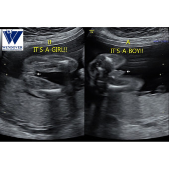 Babylist Registry Photo.
