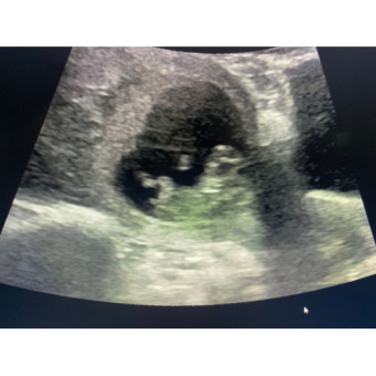 Babylist Registry Photo.