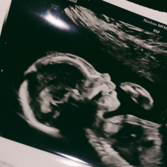 Babylist Registry Photo.