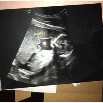 Babylist Registry Photo.