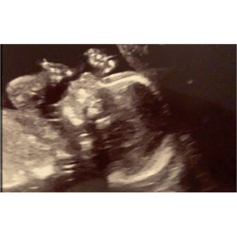 Babylist Registry Photo.