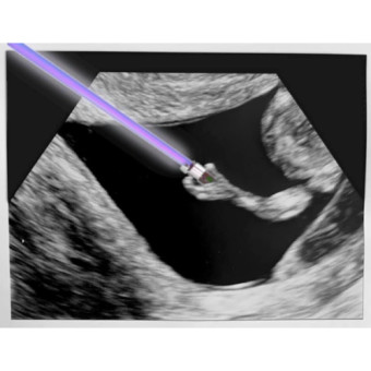 Babylist Registry Photo.