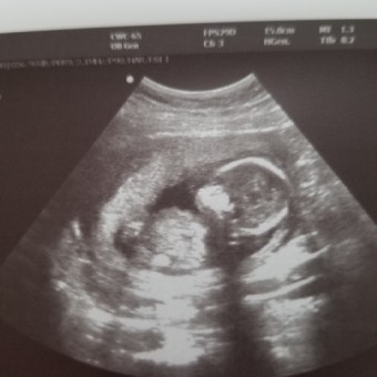 Babylist Registry Photo.