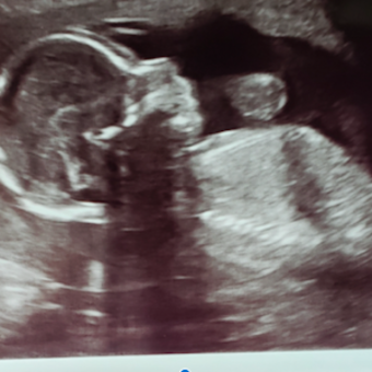 Babylist Registry Photo.