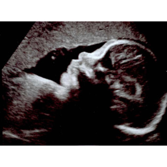 Babylist Registry Photo.