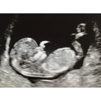 Babylist Registry Photo.