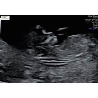 Babylist Registry Photo.