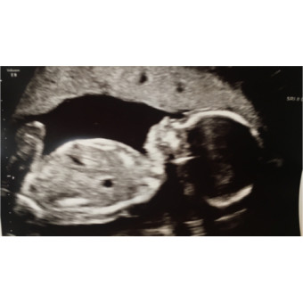 Babylist Registry Photo.
