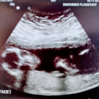 Babylist Registry Photo.