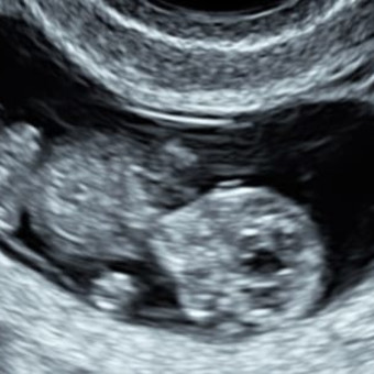 Babylist Registry Photo.