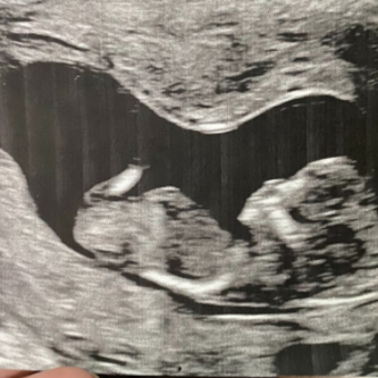 Babylist Registry Photo.