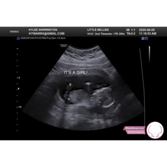 Babylist Registry Photo.