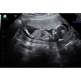 Babylist Registry Photo.