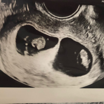 Babylist Registry Photo.