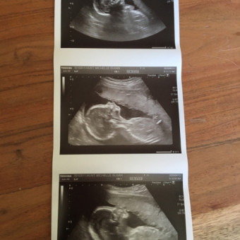 Babylist Registry Photo.