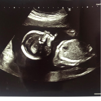 Babylist Registry Photo.
