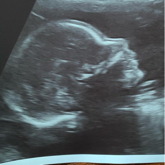 Babylist Registry Photo.