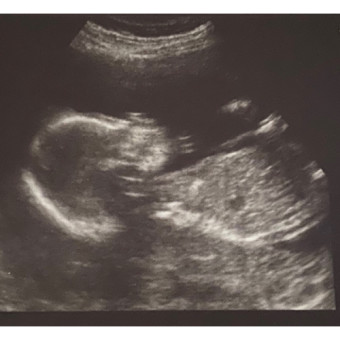 Babylist Registry Photo.