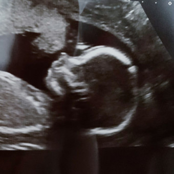 Babylist Registry Photo.