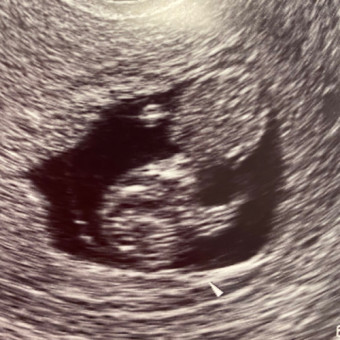 Babylist Registry Photo.