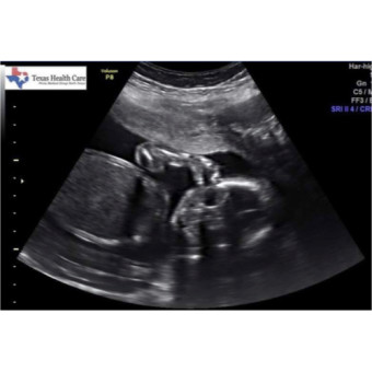 Babylist Registry Photo.