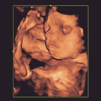 Babylist Registry Photo.