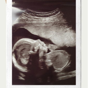 Babylist Registry Photo.
