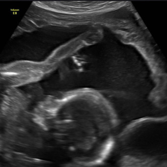 Babylist Registry Photo.