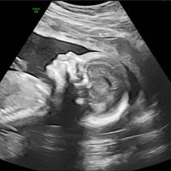 Babylist Registry Photo.
