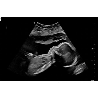 Babylist Registry Photo.
