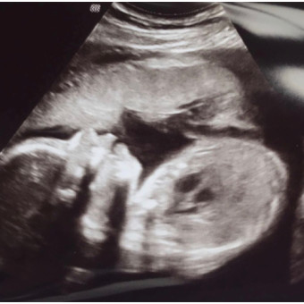 Babylist Registry Photo.