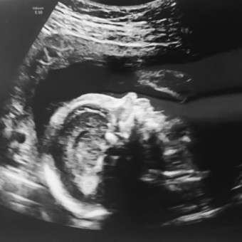 Babylist Registry Photo.
