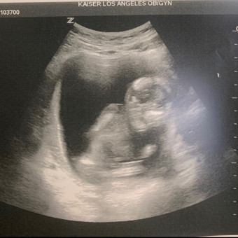 Babylist Registry Photo.