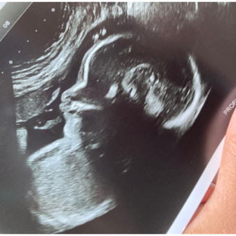 Babylist Registry Photo.