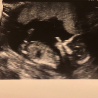 Babylist Registry Photo.