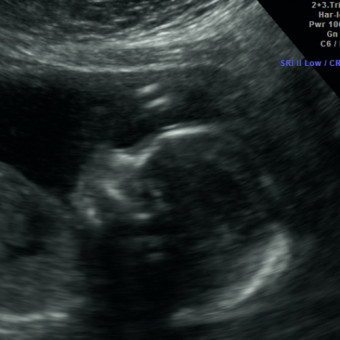 Babylist Registry Photo.