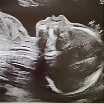 Babylist Registry Photo.