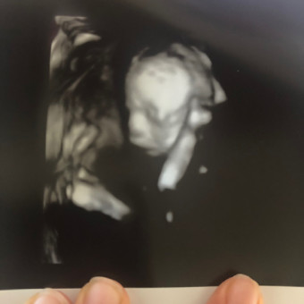 Babylist Registry Photo.