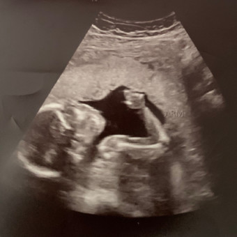 Babylist Registry Photo.