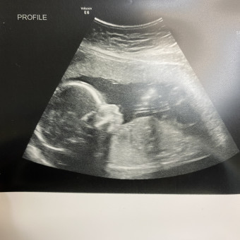 Babylist Registry Photo.